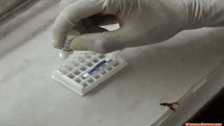 Rapid malaria test [upl. by Lotus]