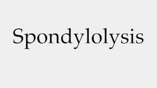 How to Pronounce Spondylolysis [upl. by Snah]