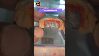 Separate Teeth Units  Sprue Metal Frame  Dentist Lab Side Work🥼  Tamil Dental Lab  viralvideo 🦷 [upl. by Easton930]