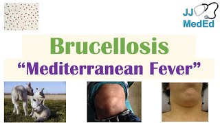 Brucellosis Mediterranean Fever  Transmission Pathogenesis Symptoms Diagnosis Treatment [upl. by Pelagias615]