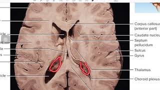 CSF and Ventricles [upl. by Maxy]