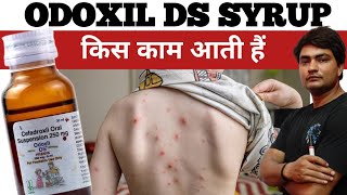 odoxil ds 250 mg syrup uses in hindi  odoxil ds 250 mg syrup uses in hindi  odoxil ds syrup [upl. by Anaujik]