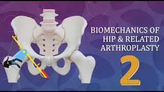 Hip Joint Biomechanics and arthroplasty Simplified Basics Part 2 of 3 [upl. by Fredrika926]