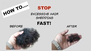 STOP Excessive Hair Shedding Fast  Tea Rinse  Natural Hair [upl. by Aniger]