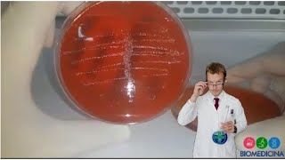 Urocultura  Entenda como interpretar o crescimento bacteriano em placas de ágar sangue 2ª parte [upl. by Weissberg]