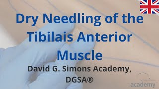 How to treat the Tibialis Anterior Muscle with Dry Needling  David G Simons Academy DGSA® [upl. by Siloa]