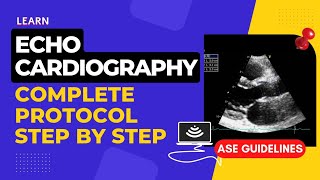 Echocardiography Standard Protocol  Step by Step  Complete Transthoracic Normal Echocardiogram [upl. by Neila]