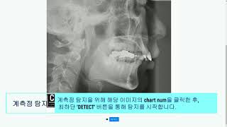 인공지능을 이용한 치과용 두부 계측점 자동 추적 방법 Identification of cephalometric landmarks [upl. by Brahear427]