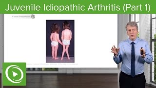 Juvenile Idiopathic Arthritis JIA Pathology amp Clinical Presentation – Pediatrics  Lecturio [upl. by Warthman224]