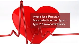 Myocardial Infarction Type 1 Type 2 amp Myocardial Injury Explained [upl. by Zeus]