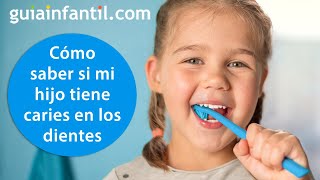 Cómo saber si un niño tiene caries en los dientes y qué hacer  Consejos de higiene de una dentista [upl. by Breed]