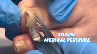 RELAXING MEDICAL PEDICURE [upl. by Dewayne]