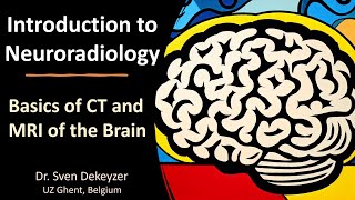 Basics of CT and MRI of the brain introduction to Neuroradiology [upl. by Atidnan]