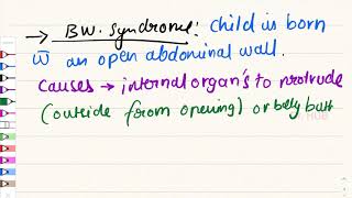 BECKWITH WIEDEMANN SYNDROME dailydosemedico [upl. by Dyoll243]