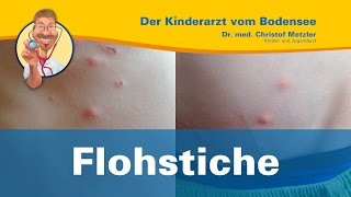 Flohstiche juckende Punkte in einer Reihe  Der Kinderarzt vom Bodensee [upl. by Datha746]