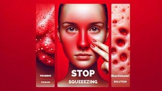 The Truth About Squeezing Blackheads [upl. by Crutcher]