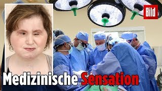 Ärzte schenken Katie ein neues Gesicht [upl. by Myrta]