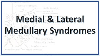 Lateral and Medullary Syndromes  Wallenberg Syndrome  PICA syndrome  Dejerine Syndrome [upl. by Aitnahc]