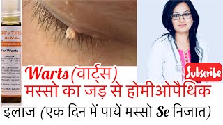 Thuja Roll On Best Homeopathic Medicine For Warts Skin Tags मस्सोंकाबेस्टदवाMolesBy DrRukmani [upl. by Olaf]