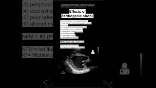 Effects of cardiogenic shock [upl. by Karee285]