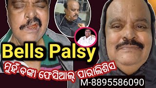 Bells PalsyFacial paralysis बेल्स पाल्सी ମୁହଁ ବଙ୍କା ହୋଇ ପାରାଲିଶିସ ଫିଜିଓ ଥେରାପିphysiotherapy [upl. by Johansen]