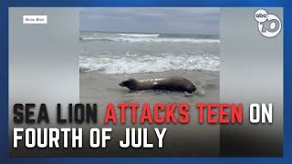 Sea lion attacks teenage boy in Del Mar on 4th of July [upl. by Nylaehs]