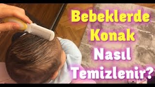 Bebeklerde Konak Nasıl Geçer bebeklerdekonak konak [upl. by Heddie]