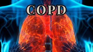 Chronic Obstructive Pulmonary Disease [upl. by Viking]