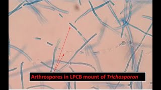 Arthroconidia of Trichosporon inkin Showing Long Cylindrical in Shape [upl. by Colan212]