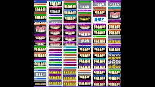 ExoCad Most Beautiful Tooth Libraries FREE [upl. by Paley341]