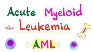 Acute Myeloid Leukemia AML  Auer Rods  Myeloperoxidase Positive  Hematology amp Oncology Series [upl. by Ellirehs]