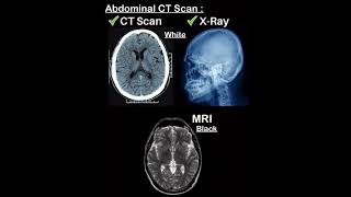 CT Scan Abdomen learning shorts 01  How to read Ct abdomen  mri vs ct abdomen and pelvis anatomy [upl. by Branen]