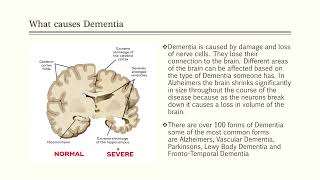 DementiaFinal Presentation [upl. by Gilges]