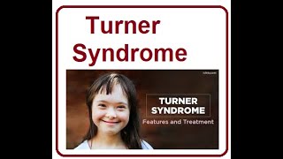 Turner Syndrome Key Facts  2024 [upl. by Shermie]