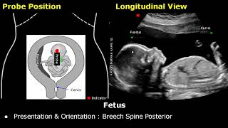 Obstetric Ultrasound Probe Positioning  Pregnant Uterus amp Fetus Transducer Placement USG Scan [upl. by Schulman531]