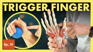 What is Trigger Finger and How Do I Fix It Stenosing Tenosynovitis [upl. by Suitangi]