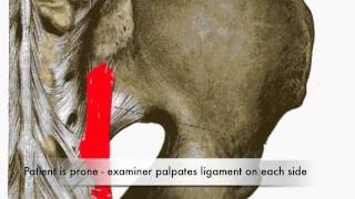 Provocation of Long Dorsal Sacroiliac Ligament Test CR [upl. by Aphra503]