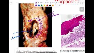 MSS pathology lab 2  part 1 [upl. by Andromache]