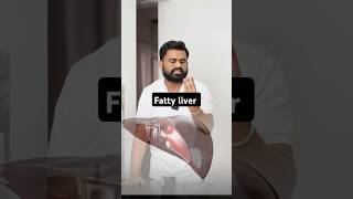 Fatty liver घर के खाने की ताकत को पहचानो drrobin health food ayurved doctor facts remedy [upl. by Notlem]