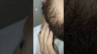 Ingrown Carly hair satisfying beard hairstyle barbershop satisfying viralshort [upl. by Enert505]