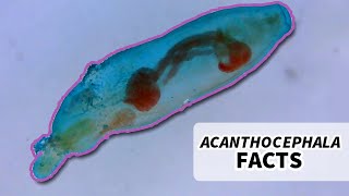 Acanthocephala Facts the Thorny Headed Worm  Animal Fact Files [upl. by Stevenson]