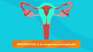 How does MISORPOSTOL work [upl. by Parker]