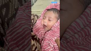 Cute Little Baby video medical viralvideo [upl. by Athelstan]