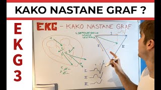 EKG 3  Kako nastane graf [upl. by Adnamaa]