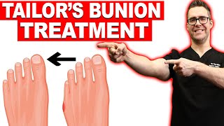 1 Tailors Bunion amp Bunionette Treatment Correctors Surgery [upl. by Martell784]