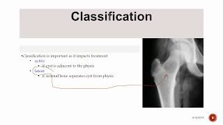 Unicameral Bone Cyst [upl. by Libove]