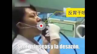 Una doctora se hace una gastroscopia a sí misma para conocer las sensaciones de los enfermos [upl. by Oicapot161]