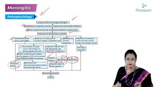 Meningitis Hindi  Internal Medicine [upl. by Coplin]