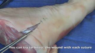 Suture  Basic Technique 2 [upl. by Honey]