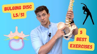 Bulging Disc L5S1 The 5 Best Exercises Explained in Detail [upl. by Barbaraanne604]